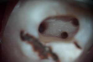 LRG_DSC00025